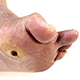 Diabetic Care