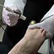 Plantar Fasciitis